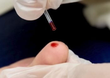 Hepatites virais em Manaus