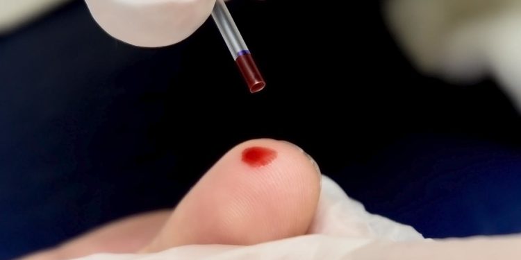 Hepatites virais em Manaus