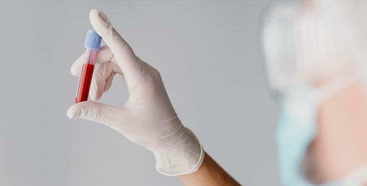 Exame de sangue para Alzheimer tem 97% de precisão no diagnóstico