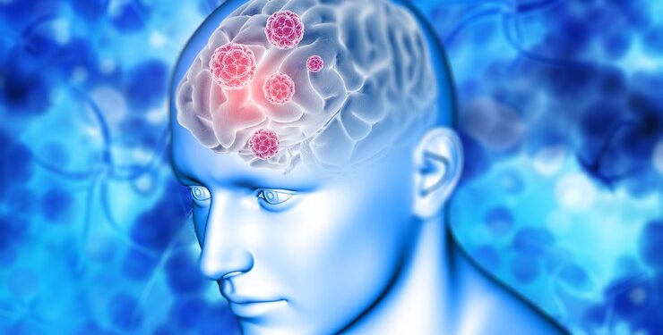 Canetas para emagrecer: Entenda possível relação com combate a doenças cerebrais