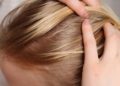 Alopécia androgenética: condição que afeta Xuxa também atinge mulheres e exige tratamento contínuo