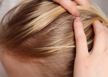 Alopécia androgenética: condição que afeta Xuxa também atinge mulheres e exige tratamento contínuo